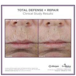 SkinMedica Total Defense And Repair SPF 34 -Cheap Dewloria Store 11289687 1924410181573815