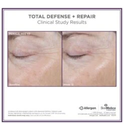 SkinMedica Total Defense And Repair SPF 34 - Tinted -Cheap Dewloria Store 11289688 9034410181162302
