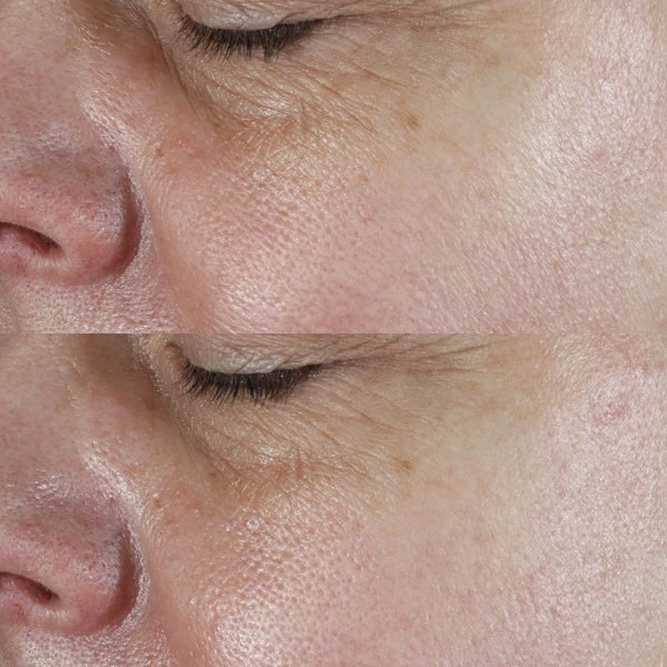 Perricone MD Face Firming Serum 4 Perricone MD Face Firming Serum - Image 4