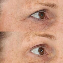 Perricone MD Essential Fx Acyl-Glutathione: Eyelid Lift Serum 9 Perricone MD Essential Fx Acyl-Glutathione: Eyelid Lift Serum -Cheap Dewloria Store 11833577 1865021901283950